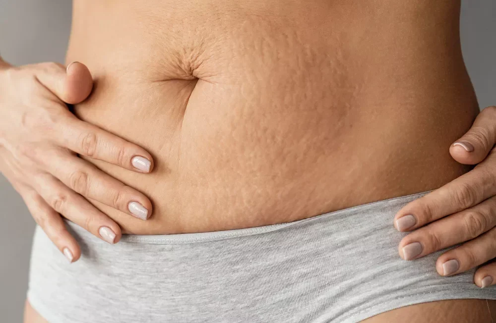 Mom’s Post-Delivery Makeover
