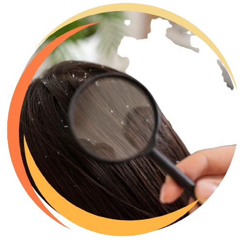 Dandruff & Scalp