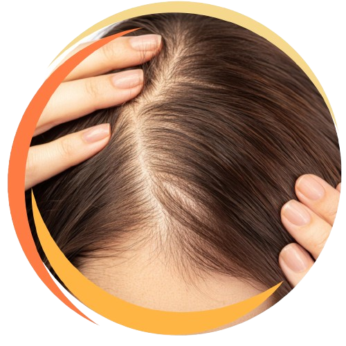 Hair Thinning
