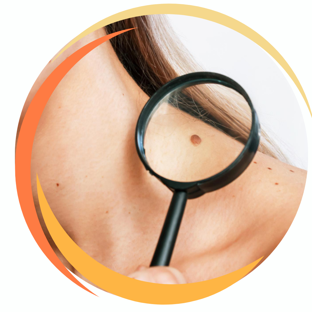 Moles