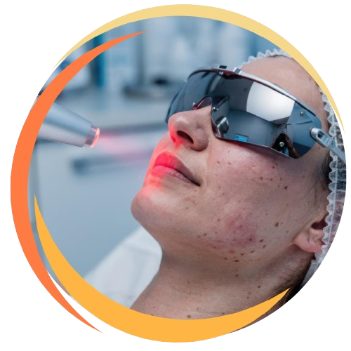 Fractional CO2 Laser
